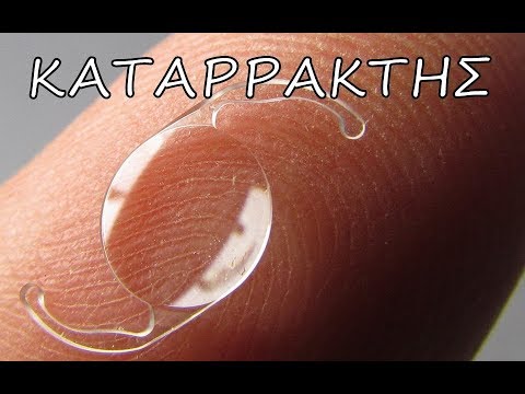 Οφθαλμίατρος Ομιλία