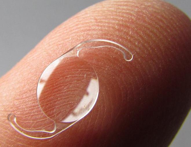 Καταρράκτης & πολυεστιακοί ενδοφακοί για διόρθωση πρεσβυωπίας Καταρράκτης